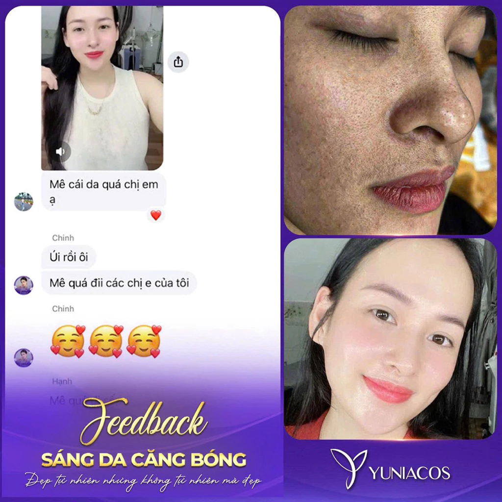 Bộ 5 Dưỡng Trắng Da Yuniacos ADA