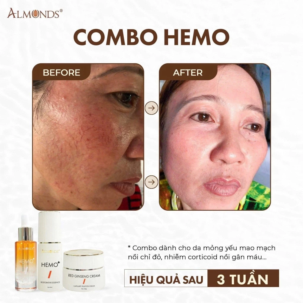 Thành phần sâm đỏ và linh chi giúp tái tạo da trắng hồng